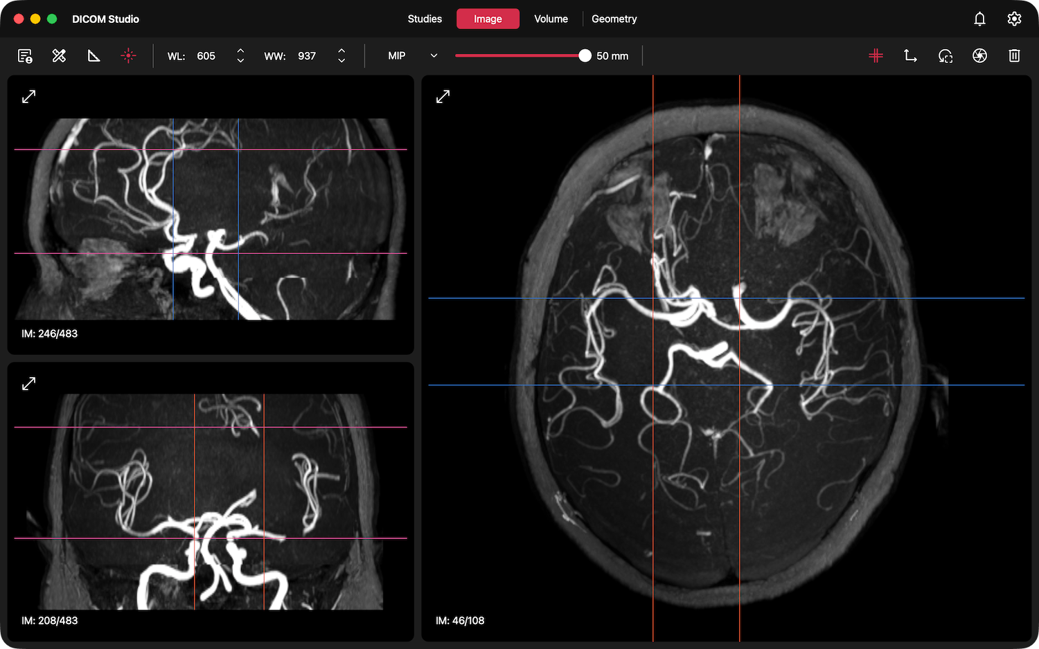 2D MPR in Image Tab