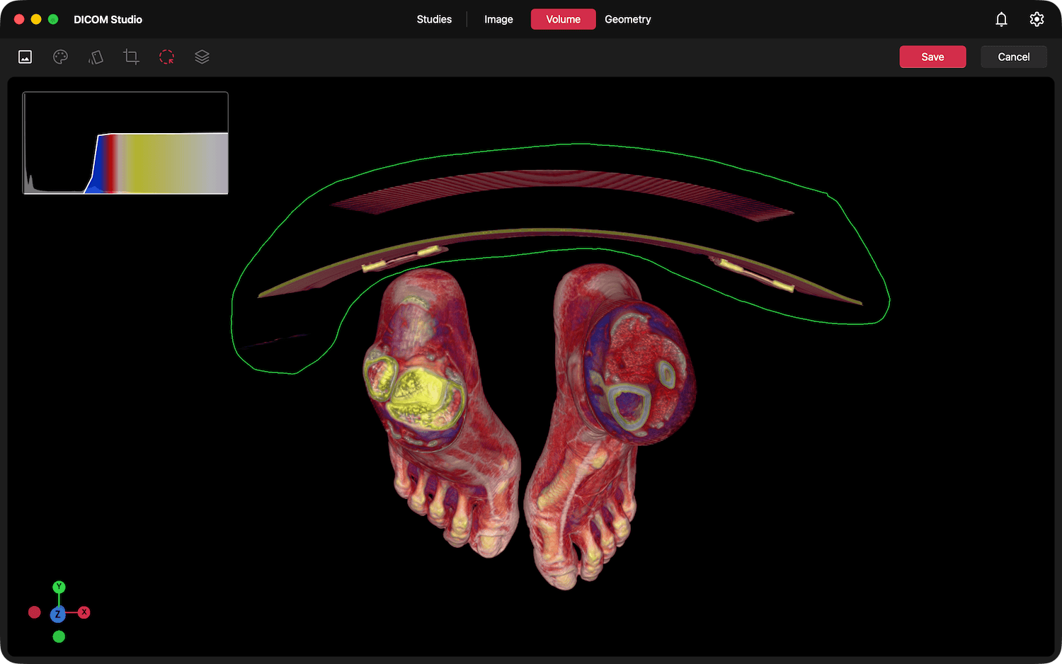 2D MPR in Image Tab