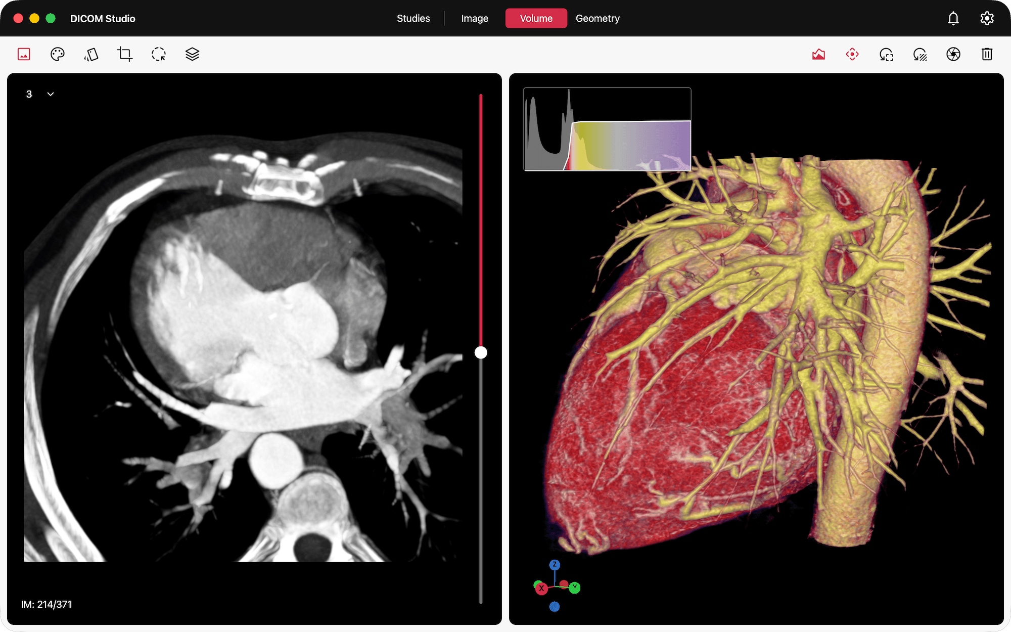 DICOM Studio on Mac