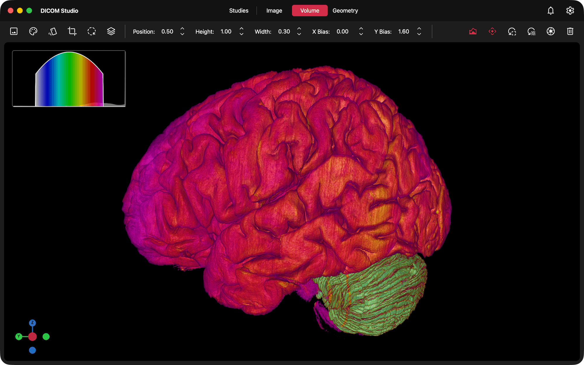 DICOM Studio on Mac
