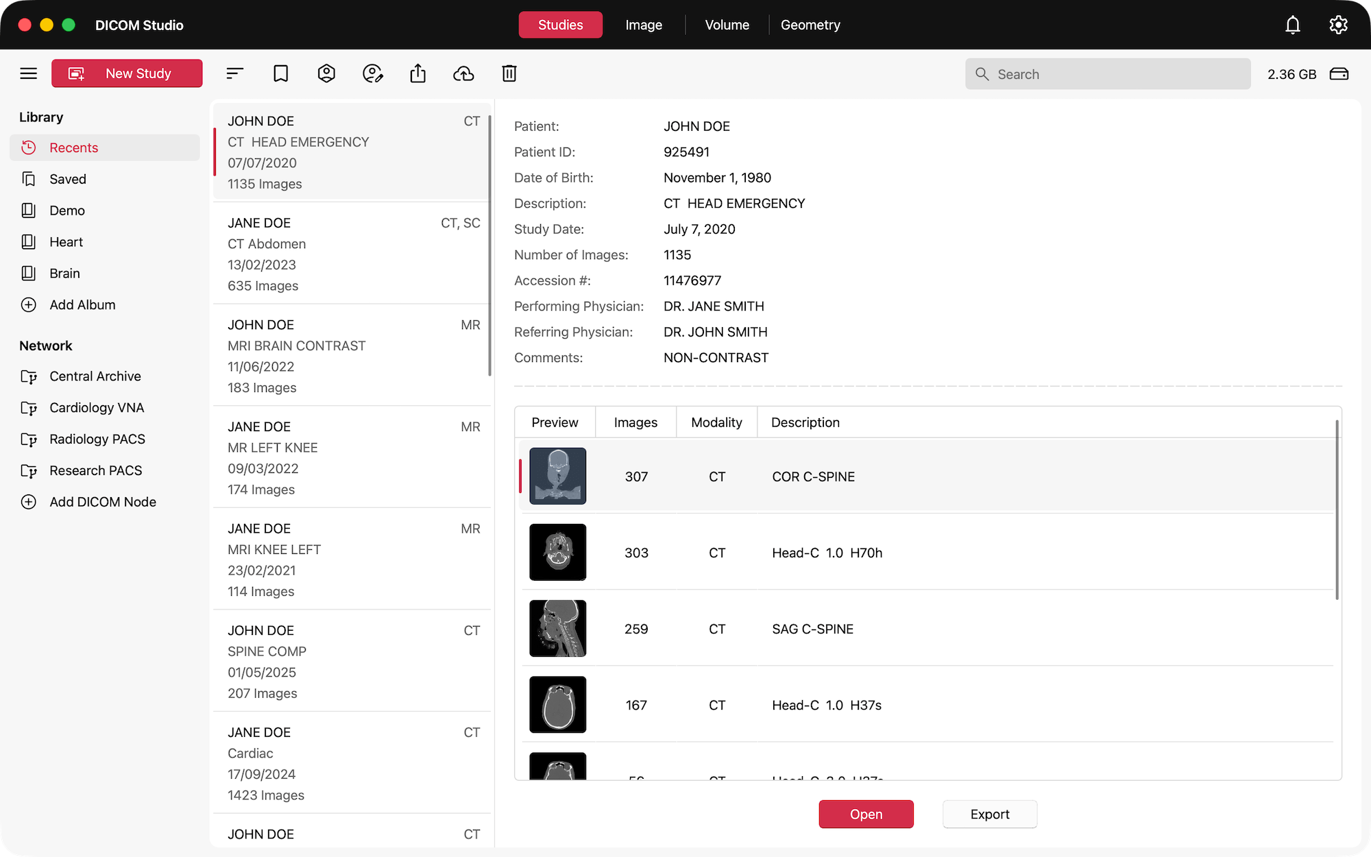 DICOM Studio on Mac
