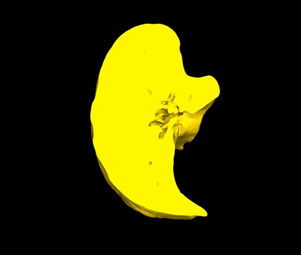 Crop with Closed Edges