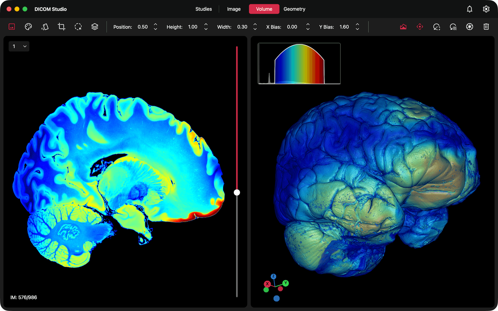 DICOM Studio on Mac
