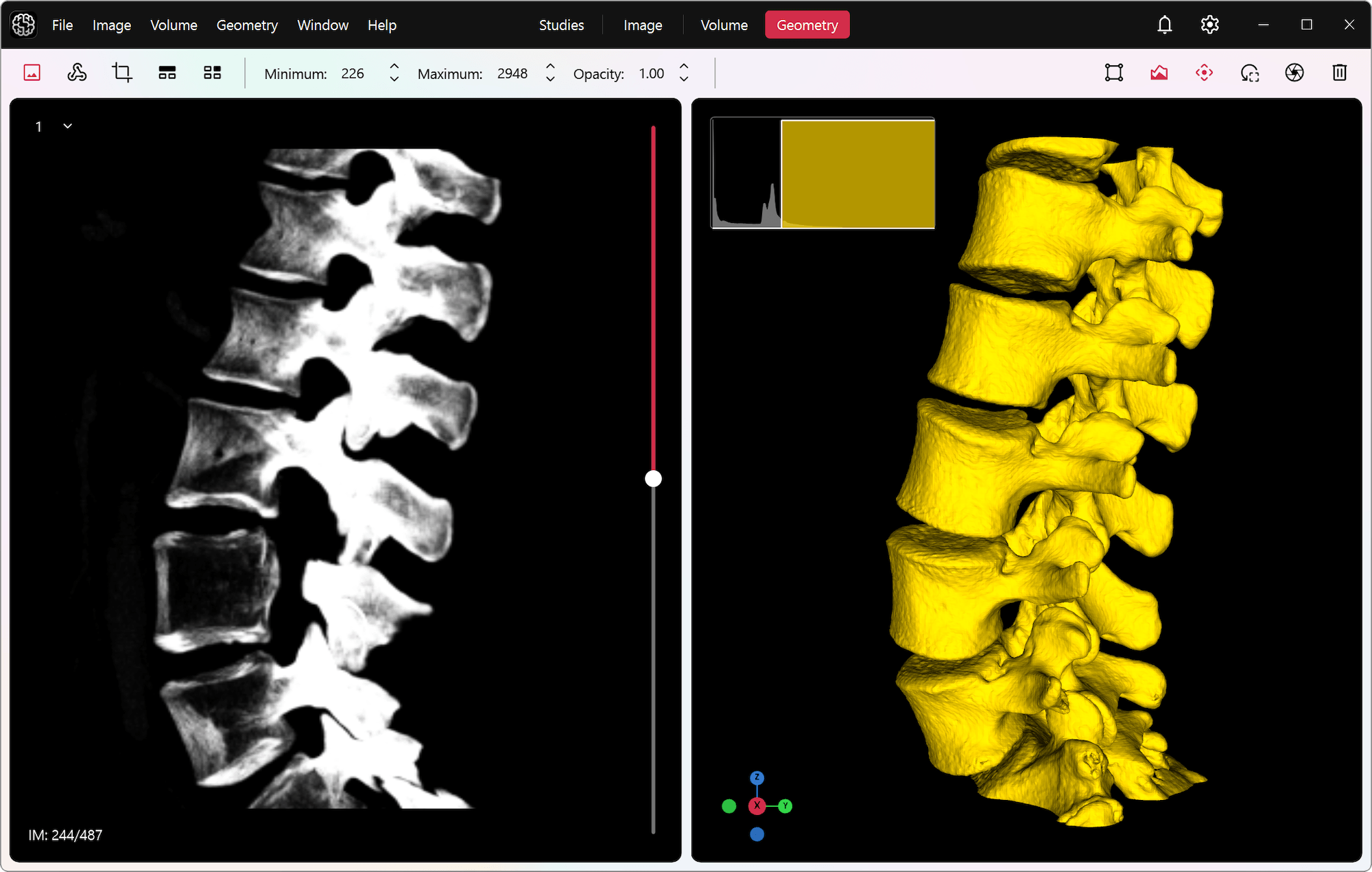 DICOM Studio on Windows