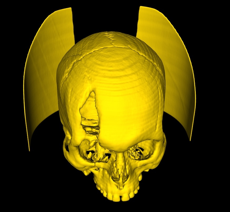 Crop with Closed Edges - DICOM Studio
