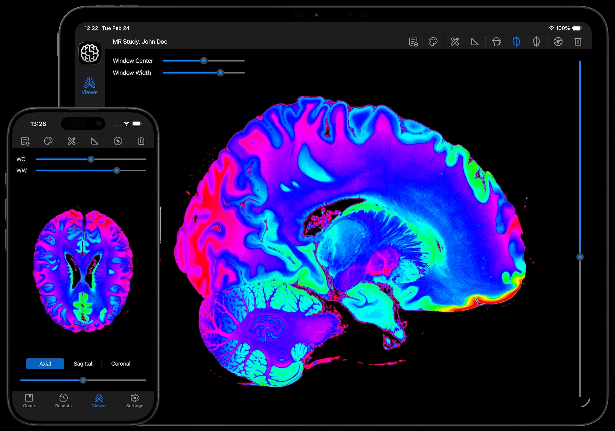 DICOM Studio Go on iPhone and iPad