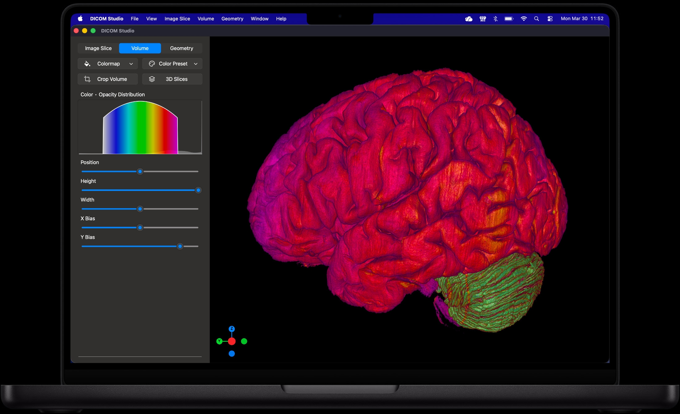 DICOM Studio on Mac