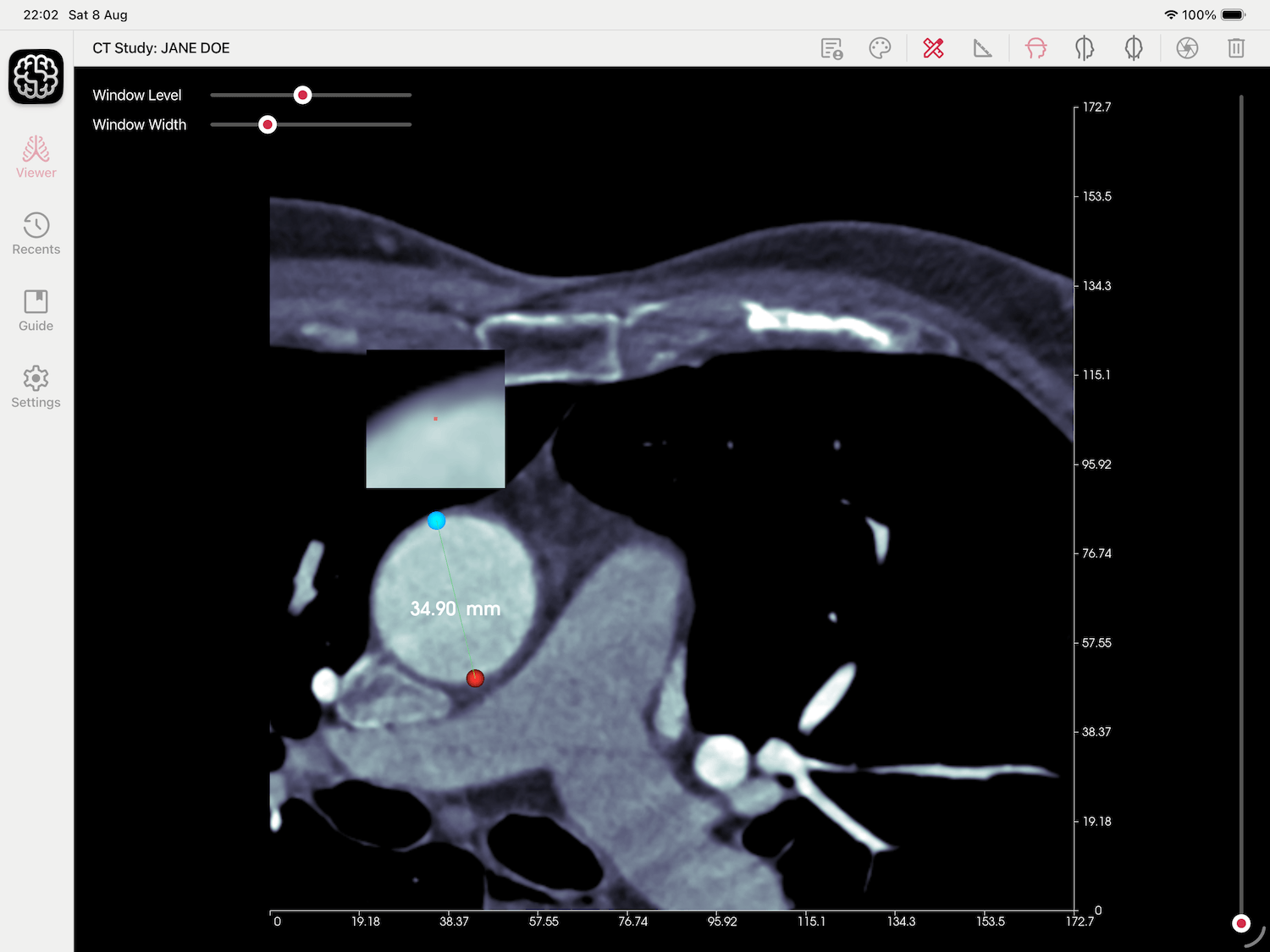 DICOM Studio on iPadOS