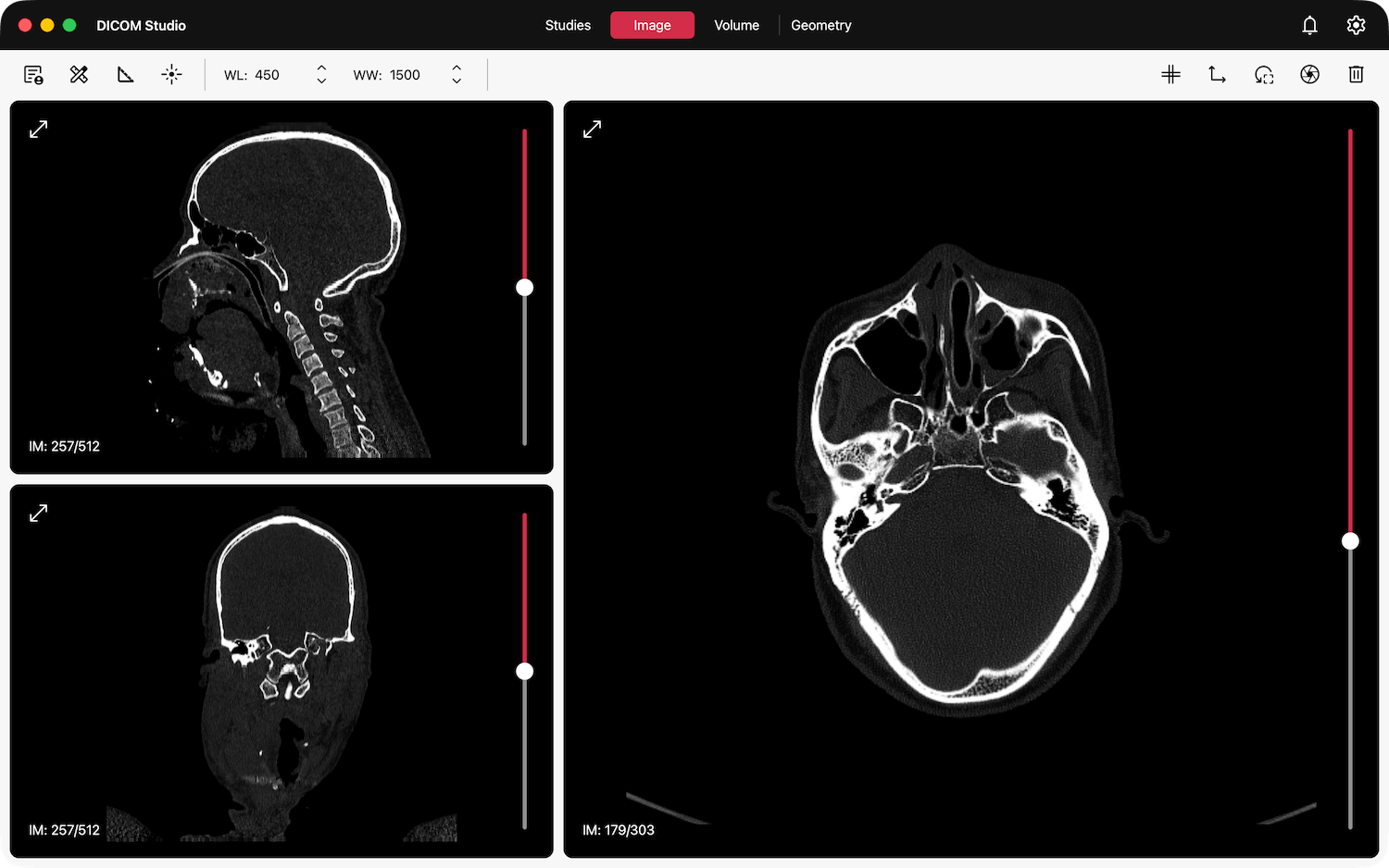 DICOM Series on Image Tab