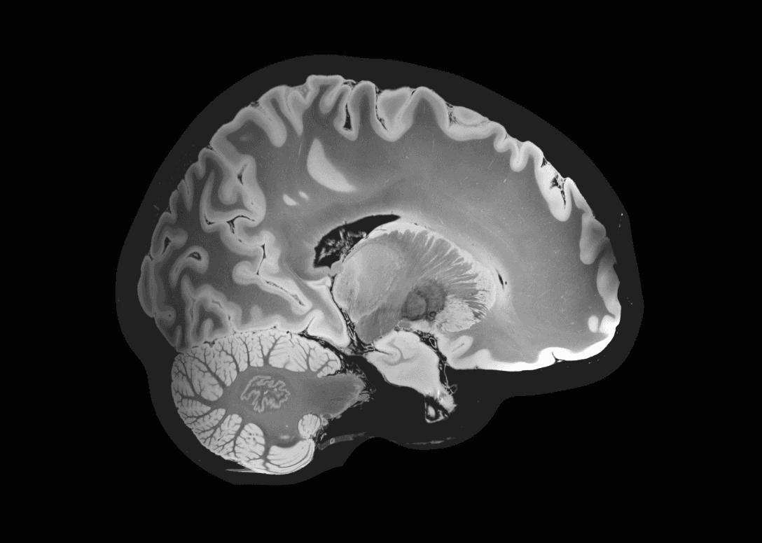 Grayscale - Before level & window adjustment