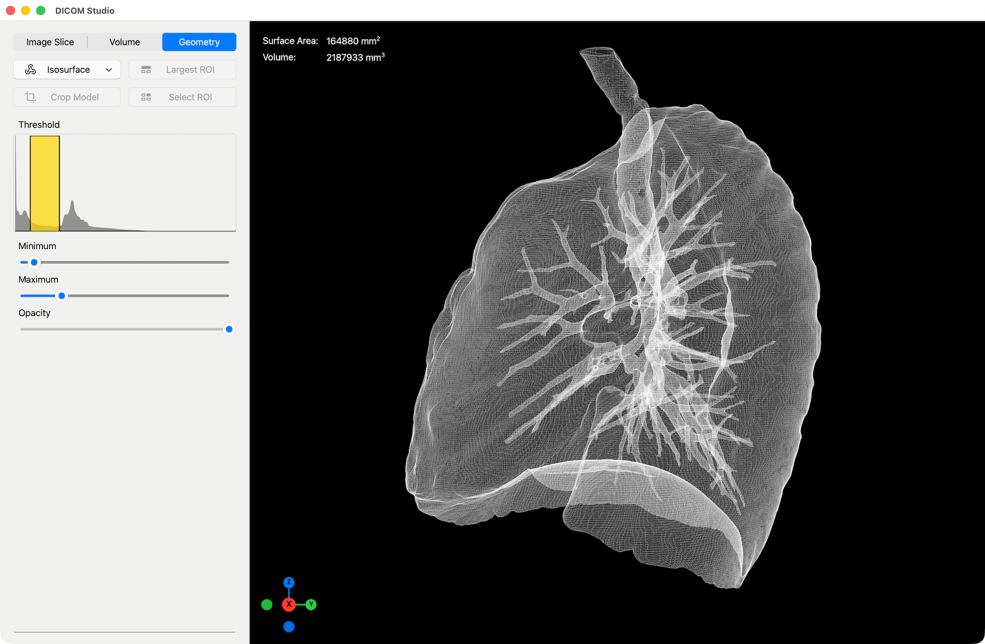 Wireframe View - DICOM Studio
