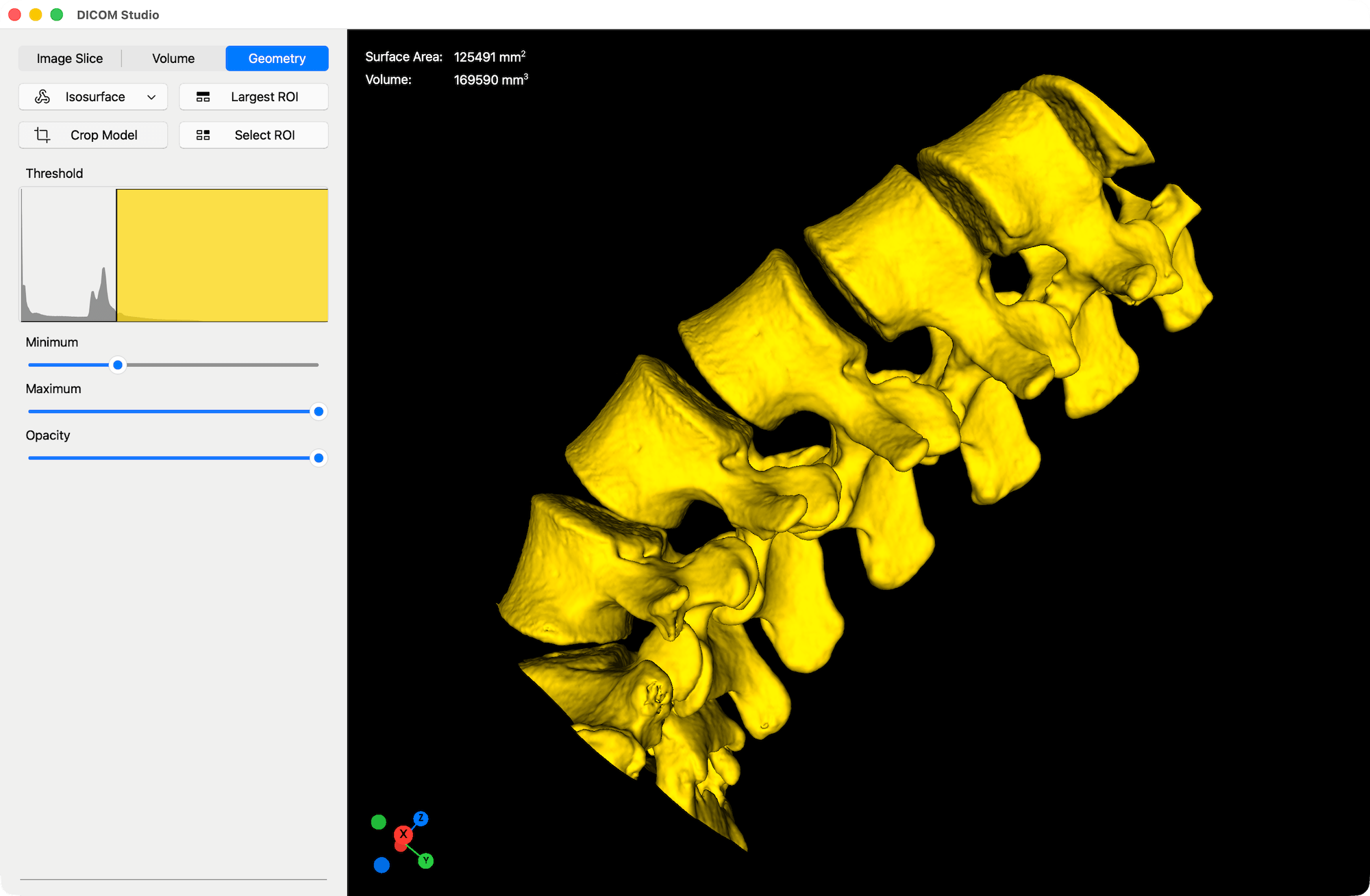 Isosurface - DICOM Studio
