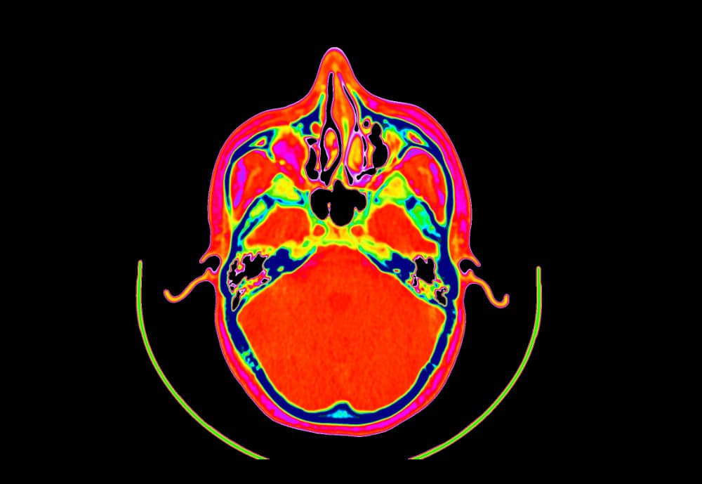 DICOM Image with Black Colormap Base