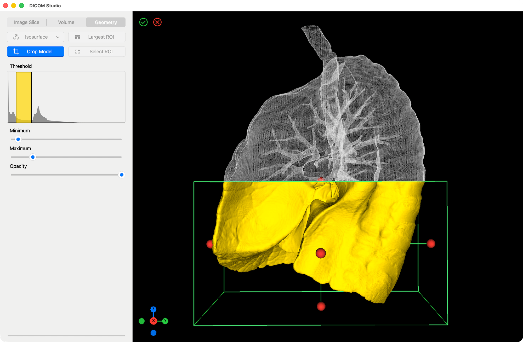 Crop Tool - DICOM Studio