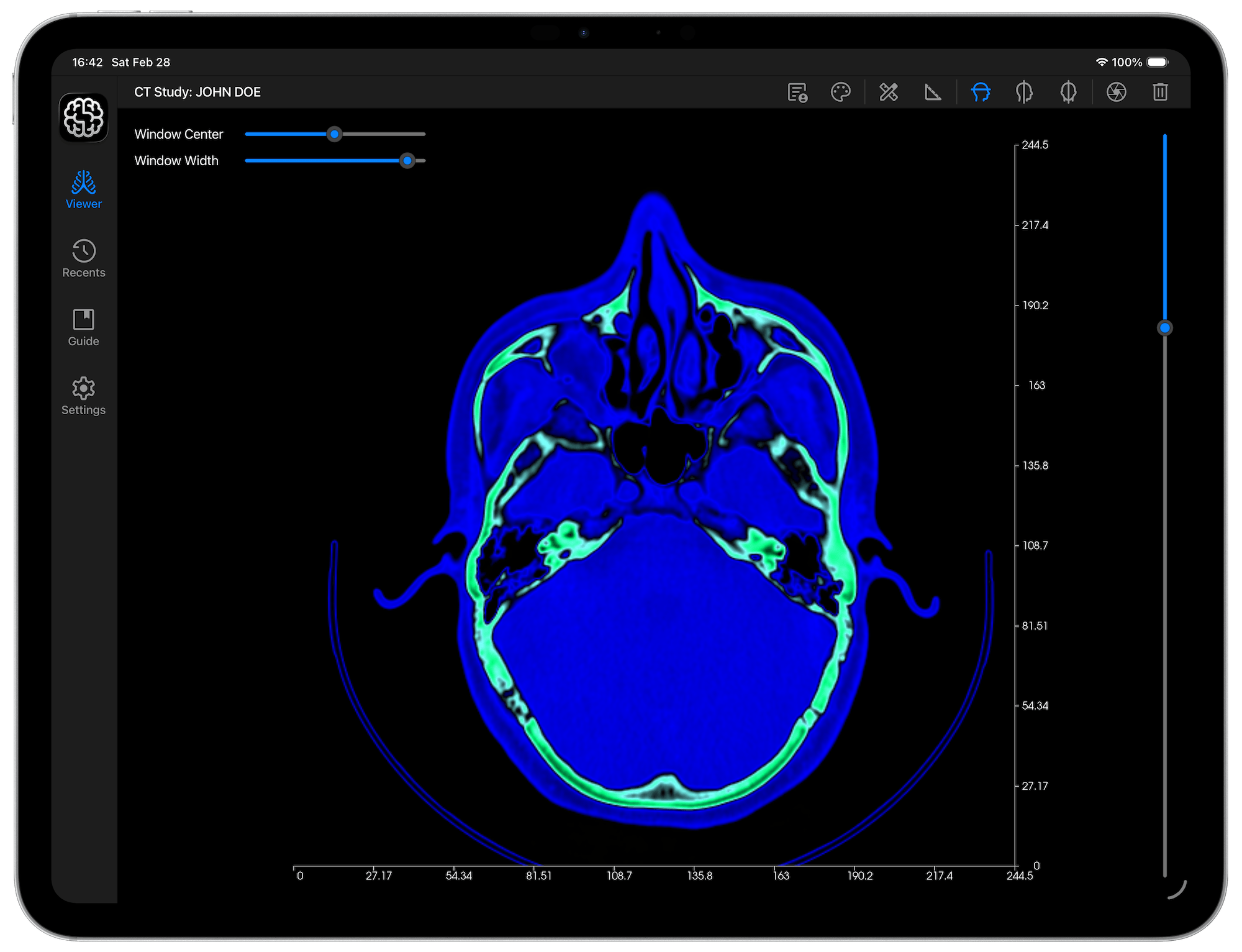 Before Colormap is Applied