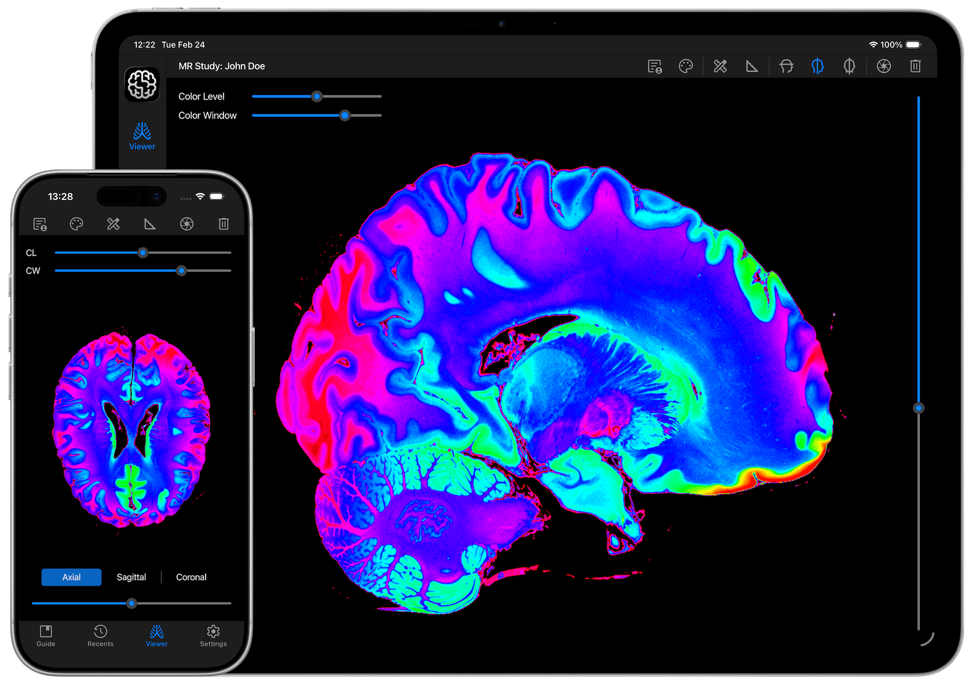 DICOM Studio Go on iPhone and iPad